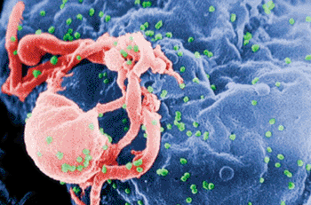 Image:  Scanning electron micrograph of HIV-1 virions budding from a lymphocyte (Photo courtesy of C. Goldsmith).